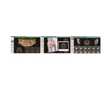 Vatech - Digital CBCT Dental 3D Imaging Systems | Green 17x15