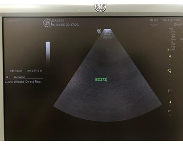 GE - 10S - [Ultrasound Transducer] [EX272]