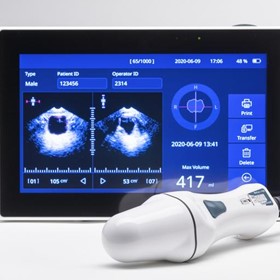 Bladder Scanner | Portable & Non-invasive