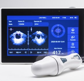 Bladder Scanner | Portable & Non-invasive
