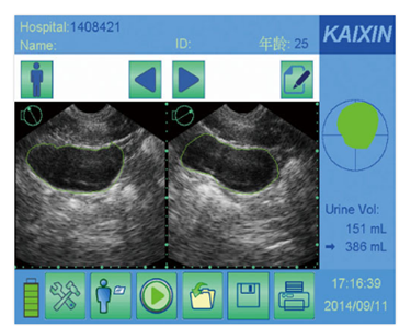 Kaixin - Bladder Scanner Ultrasound | BVT01