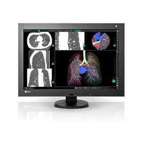 Diagnostic Monitor | RadiForce RX440 