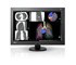 Eizo - Diagnostic Monitor | RadiForce RX440 