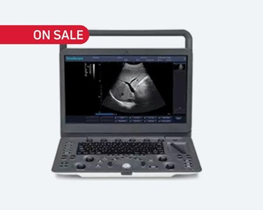 SonoScape - SonoScape E1 Ultrasound Machine WITH PROBE INCLUDED – ON SALE