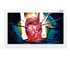Medical Monitor ASM32UHB