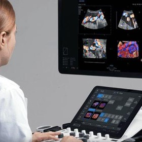 Veterinary Ultrasound Machine | Samsung V6