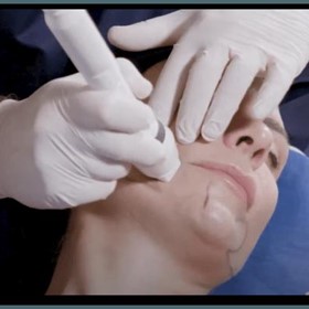 Skin Rejuvenation System | SmoothGlo