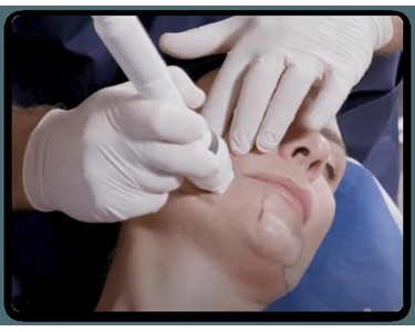 Lumenis - Skin Rejuvenation System | SmoothGlo