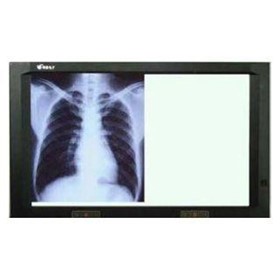 X-Ray Viewing Box | 2 Bay ATX LED