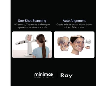 Ray - Face Scanner -Rayface 