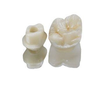 Dental Implant | General Restorative