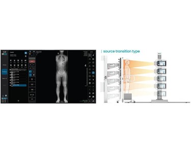 Chiropractic X-Ray Machine | DRGEM Premium 
