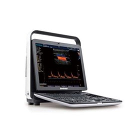 Ultrasound System | S9 Pro