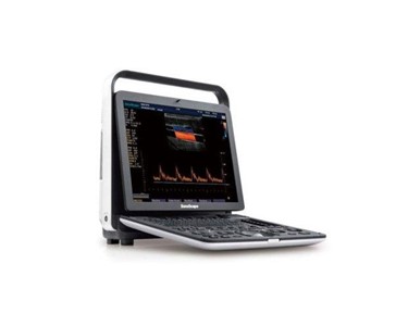 SonoScape - Portable Ultrasound System | S9 Pro