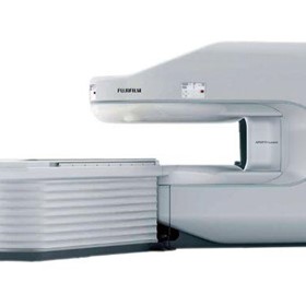 Permanent Magenet Open MRI System | APERTO Lucent with SynergyDrive