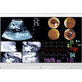 Surgical Monitor | 31.5" 4k IPS | 32HL714S​ | Medical Monitor