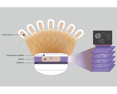 Mammgraphy - Mammography HESTIA T