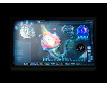 Onyx - 23.8” Slim Medical Display | MEDDP-624