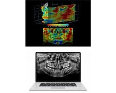 OPG X-Ray Machine | Carestream CS 8100 Evo Edition