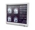 Onyx - 17" Fanless Slim Medical All In One PC | SMA-1733