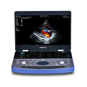  Portable Veterinary Ultrasound Machine | Vetus E7