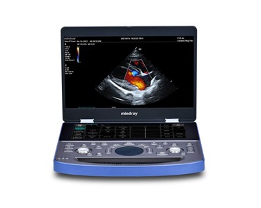 Mindray - Portable Vet Ultrasound Machine | Vetus E7