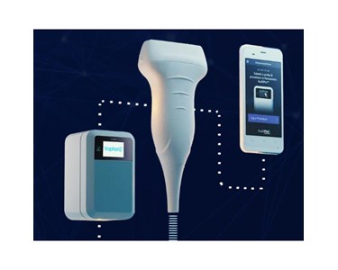 Nanosonics - Handheld Ultrasound Machine | AuditPro