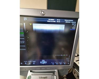 GE - Voluson S8 [Ultrasound System] [EX3070]