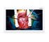 Medical Monitor ASM32U